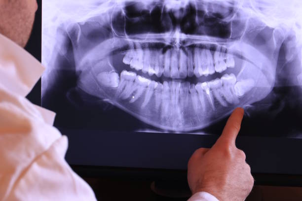 Best Broken or Cracked Tooth Emergency Dentist in Florence, TX